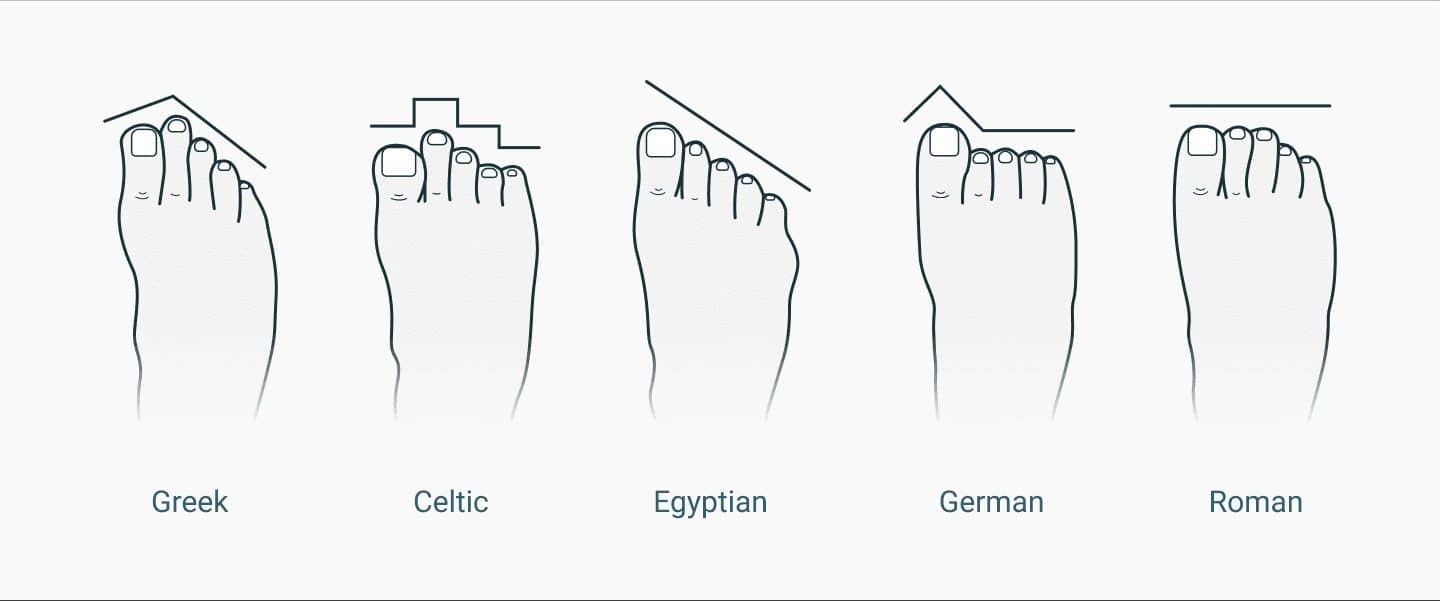 guide-foot-type-uppers-19272732-main.jpg